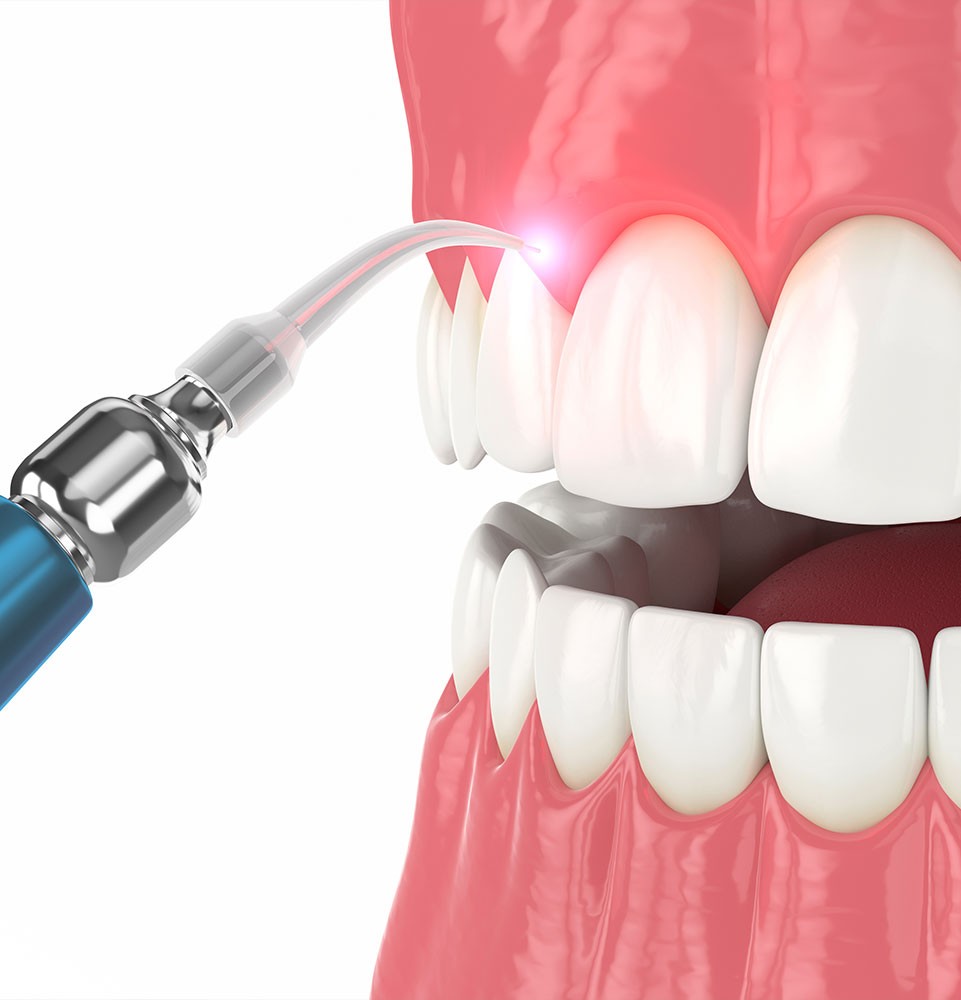 Close-up view of teeth and gums