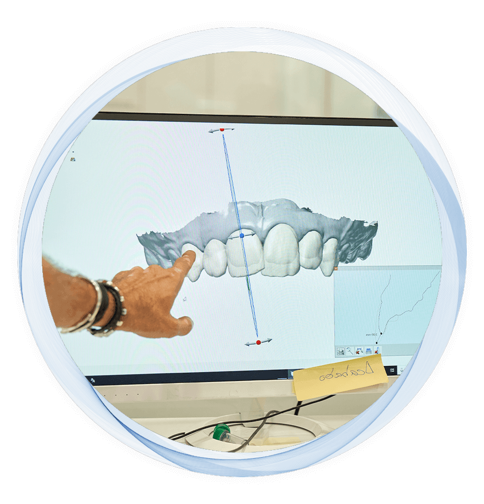 Doctor pointing at a screen displaying teeth structure