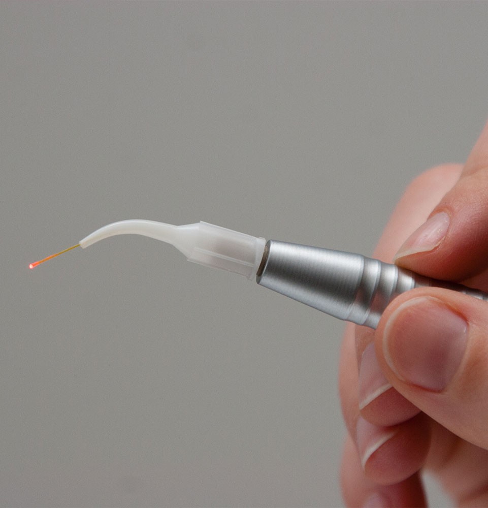 LANAP laser periodontics treatment