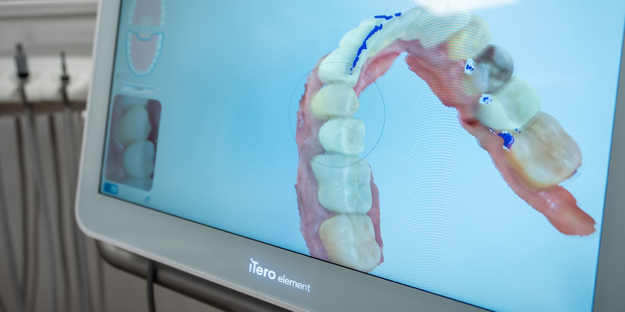 teeth anatomy displayed on a screen