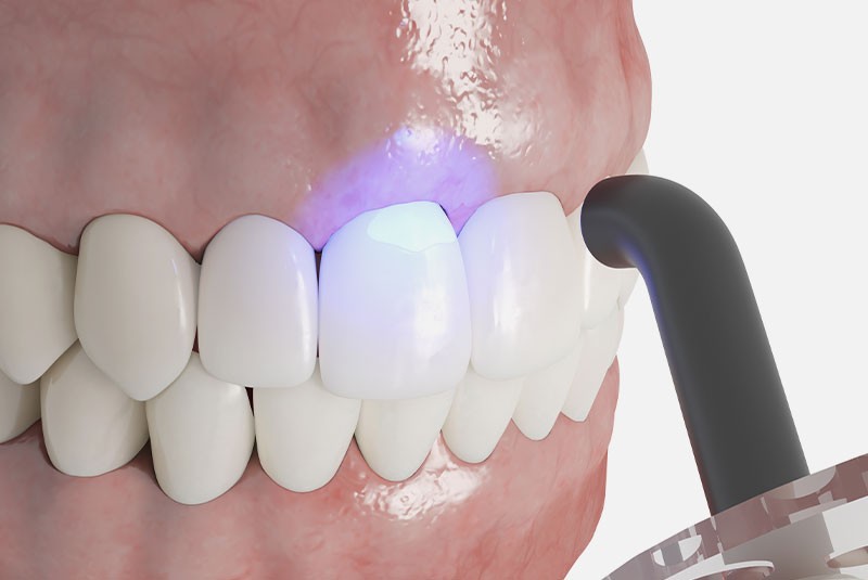 Close-up of healthy teeth